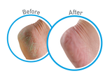 O'Keeffe's Working Hands Hand Cream, 3.4 oz and Healthy Feet Foot Cream, 3.2 oz - Value Pack - AutoCareParts.com